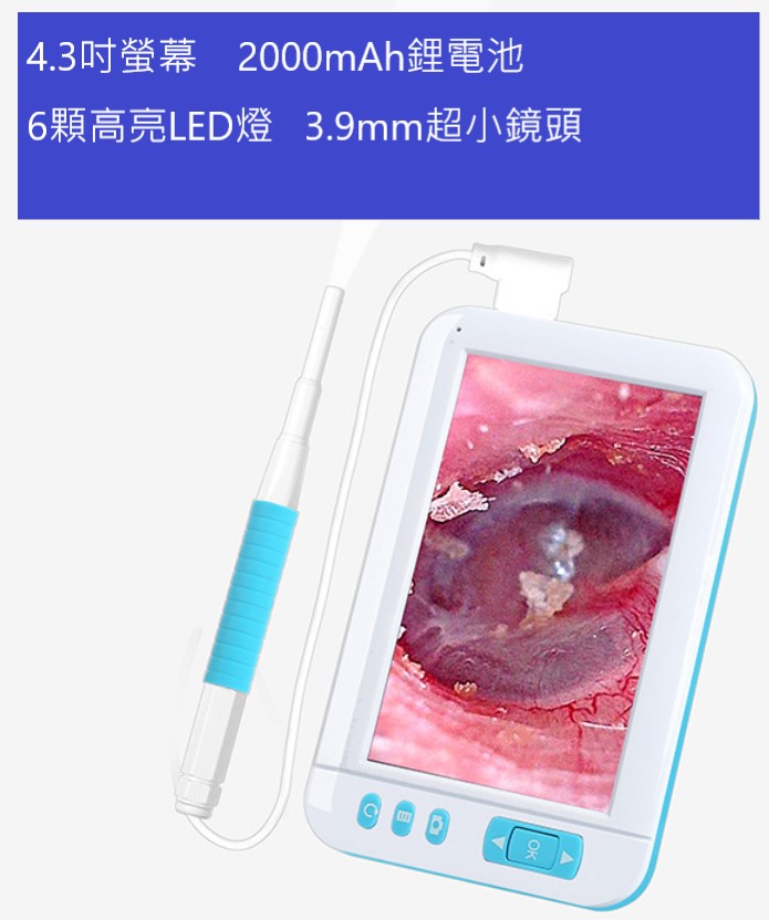 耳鼻喉內窺鏡附4 3吋螢幕 Pchome 24h購物